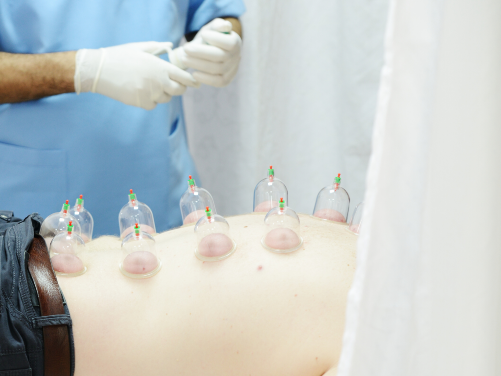 hijama voordelen